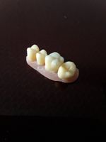 Zahntechnik/ Dental Anschauungsmodell  mit Keramik Kiel - Mitte Vorschau
